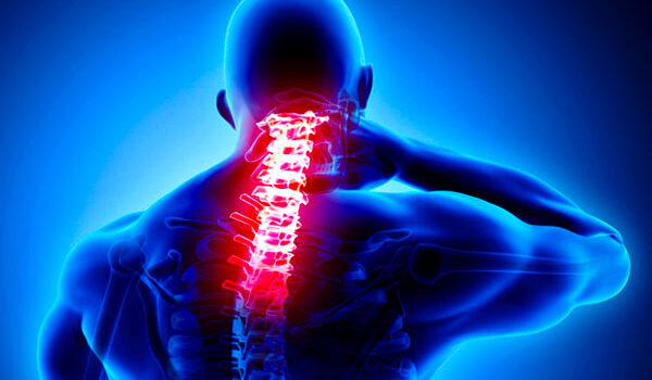 Cervical Radiculopathy Injury cervical-radiculopathy-graphic
