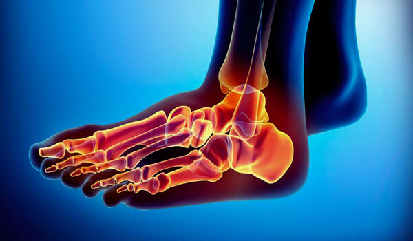 Foot and Ankle Injuries foot-and-ankle-injury-graphic