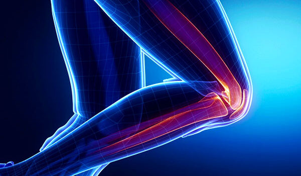 Patello Femoral Syndrome patello-femoral-syndrome-graphic