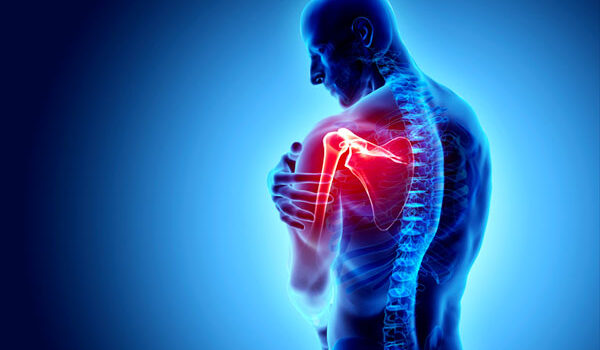 Shoulder Impingement Syndrome shoulder-impingement-syndrome-graphic