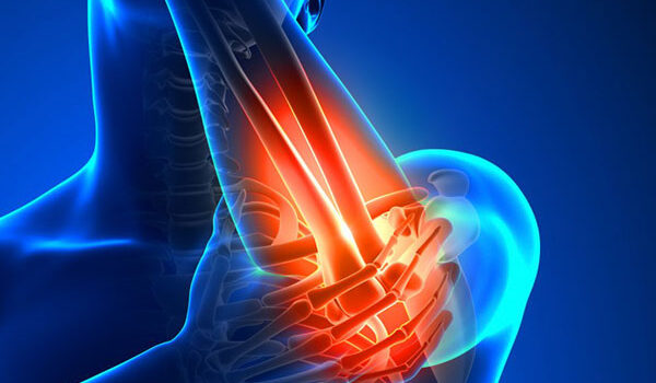 Tennis Elbow Injuries tennis-elbow-graphic